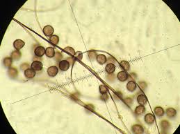 Attēlu rezultāti vaicājumam “Diderma tigrinum macro”