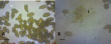 Attēlu rezultāti vaicājumam “Coleosporium sp.”