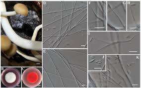 Attēlu rezultāti vaicājumam “Fuligo gyrosa spores”