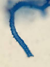 Attēlu rezultāti vaicājumam “Arcyria helvetica”