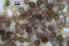 Attēlu rezultāti vaicājumam “Diderma rufostriatum spores”