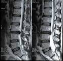 Medical <b>Imaging</b> MRI <b>risonanza</b>