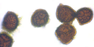 Attēlu rezultāti vaicājumam “Riccia cavernosa”