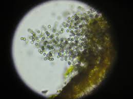 Attēlu rezultāti vaicājumam “Lichenoconium xanthoriae”