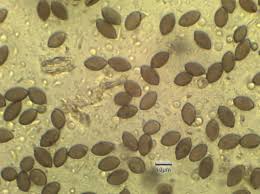 Attēlu rezultāti vaicājumam “Melanospora lagenaria”