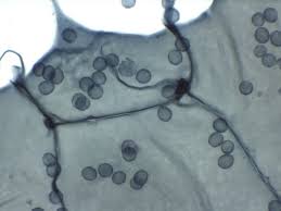 Attēlu rezultāti vaicājumam “Ophiotheca chrysosperma spores”