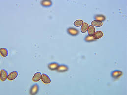 Attēlu rezultāti vaicājumam “Stemonitopsis amoena macro”
