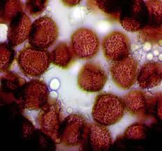 Attēlu rezultāti vaicājumam “Didymium spongiosum var. dictyospora spores”