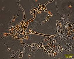 Attēlu rezultāti vaicājumam “Cribraria ferruginea stalked”