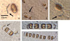 Attēlu rezultāti vaicājumam “Diachea dictyospora (syn. Craterium dictyosporum) spores”