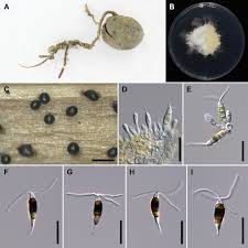 Attēlu rezultāti vaicājumam “Stemonitopsis aequalis var. microspora stalked”