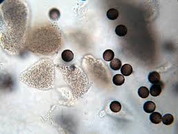 Attēlu rezultāti vaicājumam “Physarum bitectum”