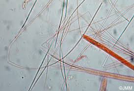 Attēlu rezultāti vaicājumam “Vibrissea decolorans”