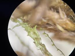 Attēlu rezultāti vaicājumam “Cephaloziella elachista macro”