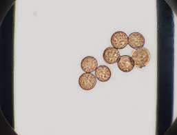 Attēlu rezultāti vaicājumam “Badhamia affinis var. microspora spores”