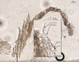 Attēlu rezultāti vaicājumam “Collembola”