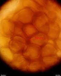 Attēlu rezultāti vaicājumam “Lycogala cf. fossiculatum”