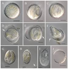 Attēlu rezultāti vaicājumam “Heterotrichia oerstedii (syn. Arcyria oerstedii) macro”