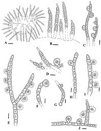 Attēlu rezultāti vaicājumam “Trentepohlia sp.”