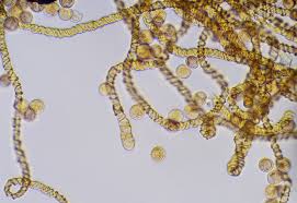 Attēlu rezultāti vaicājumam “Hemitrichia sordivesiculosa”