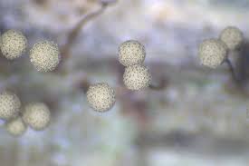 Attēlu rezultāti vaicājumam “Cribraria macrocarpa”