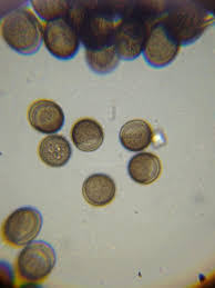 Attēlu rezultāti vaicājumam “Licea testudinacea spores”