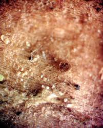 Attēlu rezultāti vaicājumam “Licea minima sessile”