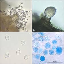 Attēlu rezultāti vaicājumam “Cribraria microcarpa spores”