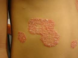 Attēlu rezultāti vaicājumam “Reticularia jurana young”