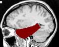 hippocampus