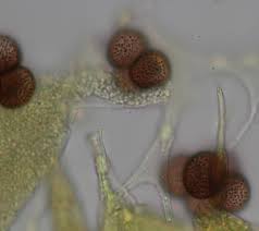 Attēlu rezultāti vaicājumam “Badhamia nitens spores”