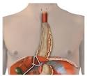 Minimally Invasive Esophagectomy