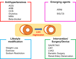 Image result for  ^ L V [ h    