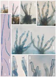 Attēlu rezultāti vaicājumam “Stemonitopsis aequalis var. microspora”