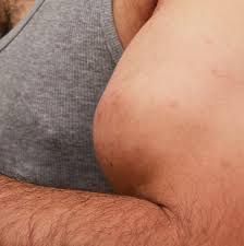 Image result for SYNTHOL