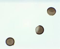 Attēlu rezultāti vaicājumam “Licea pusilla macro”