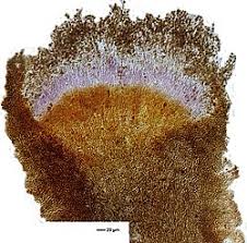 Attēlu rezultāti vaicājumam “Chaenotheca ferruginea”