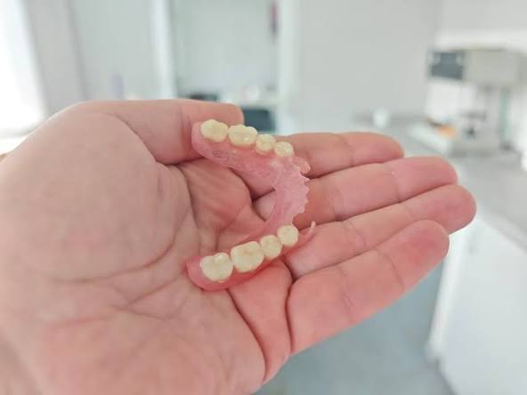 Flexible Dentures Kingston