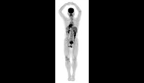 Image result for body scanner