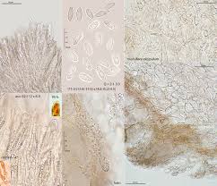 Attēlu rezultāti vaicājumam “Cudoniella clavus”