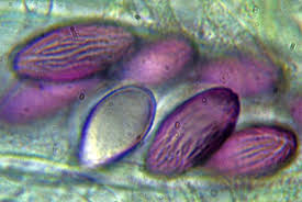 Attēlu rezultāti vaicājumam “Ascobolus furfuraceus”