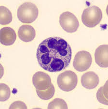 Attēlu rezultāti vaicājumam “Diderma umbilicatum plasmodium”