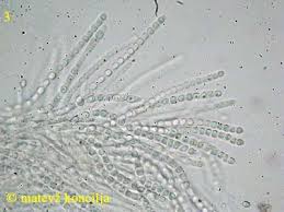 Attēlu rezultāti vaicājumam “Hypocrea rufa”