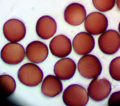 Attēlu rezultāti vaicājumam “Lycogala cf. oleocrystalliferum”