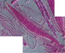 Attēlu rezultāti vaicājumam “Petractis sp.”