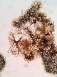 Attēlu rezultāti vaicājumam “Cribraria piriformis spores”