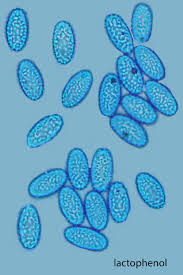 Attēlu rezultāti vaicājumam “Sowerbyella radiculata”
