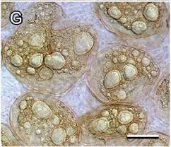 Attēlu rezultāti vaicājumam “Lycogala miserum macro”