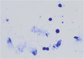 Attēlu rezultāti vaicājumam “Colloderma sp.”