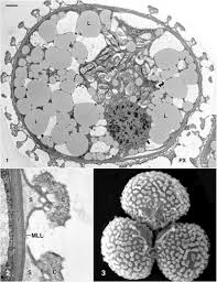 Attēlu rezultāti vaicājumam “Fossombronia wondraczekii spores”